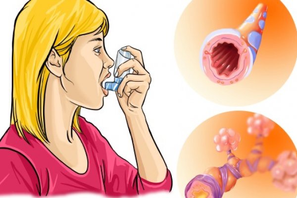 astma-lijek